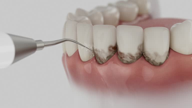 Reliable Teeth Cleaning And Checkup contractor in Montgomery County County, AL by Dentist Open Now